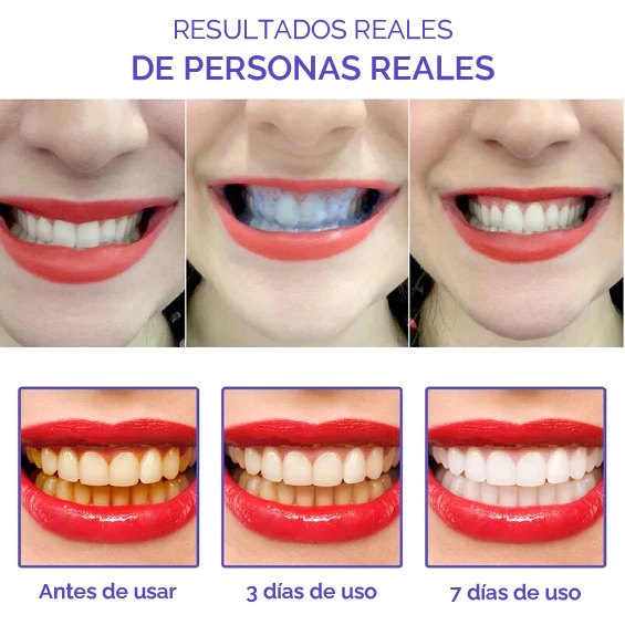 Smile kit - Dientes blancos D