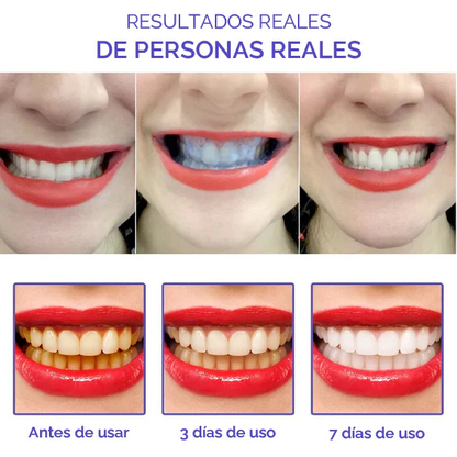 Smile kit - Dientes blancos D